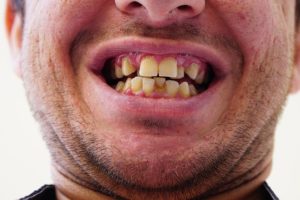 teeth