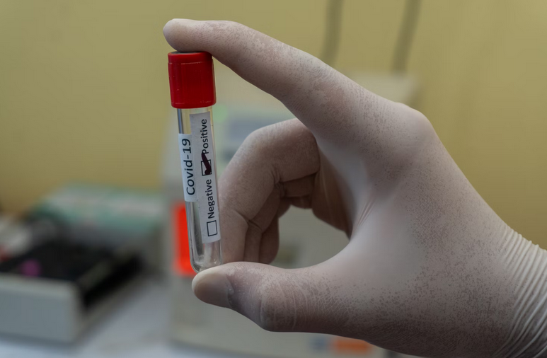 Beyond the Q-Tip: Millennial-Approved Tips for Getting the Best COVID-19 Test